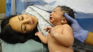 C-section birth