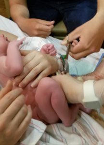 delayed cord clamping